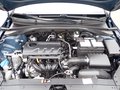 Daumennagel 3 - Kia Ceed 1.4 Vision AHK|NAV|DAB|SHZ|TEMP|RFK|KLIMA