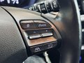 Daumennagel 22 - Hyundai i30 Trend Mild-Hybrid CARPLAY|SHZ|LHZ|KAMERA|ACC