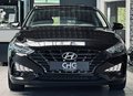Daumennagel 2 - Hyundai i30 Trend Mild-Hybrid CARPLAY|SHZ|LHZ|KAMERA|ACC