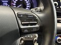 Daumennagel 20 - Hyundai i30 Trend Mild-Hybrid KAMERA|SHZ|CARPLAY|