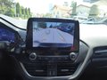 Daumennagel 17 - Ford Fiesta ST-Line X
