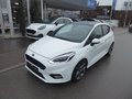 Daumennagel 1 - Ford Fiesta ST-Line aus 1. Hand
