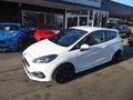 Daumennagel 1 - Ford Fiesta ST
