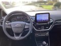 Daumennagel 6 - Ford Fiesta 1.0 EcoBoost S&S TITANIUM NAVI LED