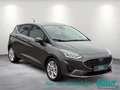 Daumennagel 2 - Ford Fiesta 1,0 EcoBoost TITANIUM X Winter Komfort