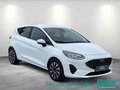 Daumennagel 2 - Ford Fiesta 1.0 EcoBoost S&S TITANIUM Winter-Paket