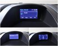 Daumennagel 16 - Ford Fiesta Titanium 1.5 TDCi KLIMA SHZ PDC BT