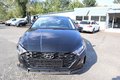 Daumennagel 4 - Hyundai i20 1.0i Select Klima. PDC. SHZ.