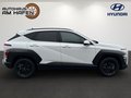 Daumennagel 3 - Hyundai KONA 1,0 T-GDI Trend 2WD