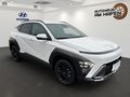Daumennagel 2 - Hyundai KONA 1,0 T-GDI Trend 2WD