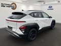 Daumennagel 4 - Hyundai KONA 1,0 T-GDI Trend 2WD