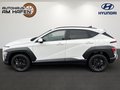 Daumennagel 6 - Hyundai KONA 1,0 T-GDI Trend 2WD