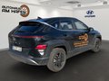 Daumennagel 4 - Hyundai KONA SX2
