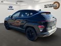 Daumennagel 5 - Hyundai KONA SX2