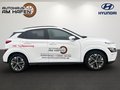 Daumennagel 3 - Hyundai KONA Trend Elektro 2WD