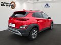 Daumennagel 4 - Hyundai KONA Edition 30 Hybrid 2WD