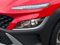 Daumennagel 7 - Hyundai KONA Edition 30 Hybrid 2WD