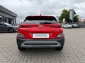 Daumennagel 11 - Hyundai KONA Edition 30 Hybrid 2WD
