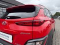 Daumennagel 12 - Hyundai KONA Edition 30 Hybrid 2WD