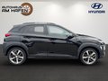 Daumennagel 5 - Hyundai KONA Advantage + 2WD