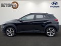 Daumennagel 6 - Hyundai KONA Advantage + 2WD