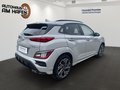 Daumennagel 3 - Hyundai KONA N Line 2WD