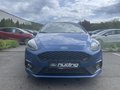Daumennagel 3 - Ford Fiesta ST 1.5 EcoBoost Leder-Exklusiv Paket