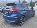 Daumennagel 6 - Ford Fiesta ST 1.5 EcoBoost Leder-Exklusiv Paket