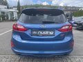 Daumennagel 7 - Ford Fiesta ST 1.5 EcoBoost Leder-Exklusiv Paket