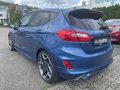 Daumennagel 9 - Ford Fiesta ST 1.5 EcoBoost Leder-Exklusiv Paket