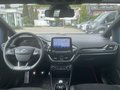 Daumennagel 15 - Ford Fiesta ST 1.5 EcoBoost Leder-Exklusiv Paket