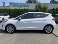 Daumennagel 10 - Ford Fiesta 1.5 TDCi Titanium ACC/Navi/RFK/SZH