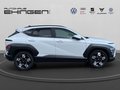 Daumennagel 5 - Hyundai KONA 1.6 T-GDI Prime 2WD Navi+Kamera