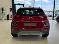 Daumennagel 5 - Hyundai KONA Style 2WD 1.6 Automatik|Kamera|Krell|Navi