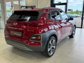 Daumennagel 6 - Hyundai KONA Style 2WD 1.6 Automatik|Kamera|Krell|Navi