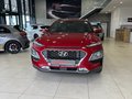 Daumennagel 2 - Hyundai KONA Style 2WD 1.6 Automatik|Kamera|Krell|Navi