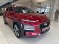 Daumennagel 3 - Hyundai KONA Style 2WD 1.6 Automatik|Kamera|Krell|Navi