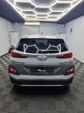 Daumennagel 7 - Hyundai KONA Advantage Elektro 2WD|NAVI|LM FELGEN|ACC|SOUND