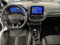 Daumennagel 7 - Ford Fiesta ST
