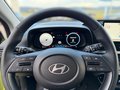 Daumennagel 8 - Hyundai i20 Trend 1.0 T-GDI 100 PS 6-M/T Komfortpaket