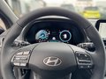 Daumennagel 8 - Hyundai i30 Kombi 1.5 T-GDI 140 PS 48V 7-DCT Advantage  Mild-Hybrid