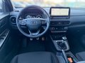 Daumennagel 10 - Hyundai KONA 1.0 T-GDI 120 PS N LINE 2WD N Line Mild-Hybrid