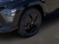 Daumennagel 6 - Hyundai KONA Trend Elektro 2WD 65kWh 204 PS