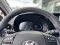Daumennagel 8 - Hyundai i10 Trend 1.2 79PS 5-AMT Komfortpaket